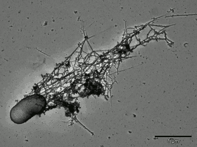Listeria with actin under SEM